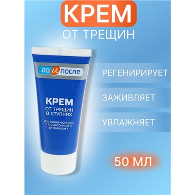 Крем для ног от трещин в ступнях, "До и После", 50 мл